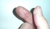 Motsens fingre efter at have fjernet Suzuki og Swift emblemet bagp